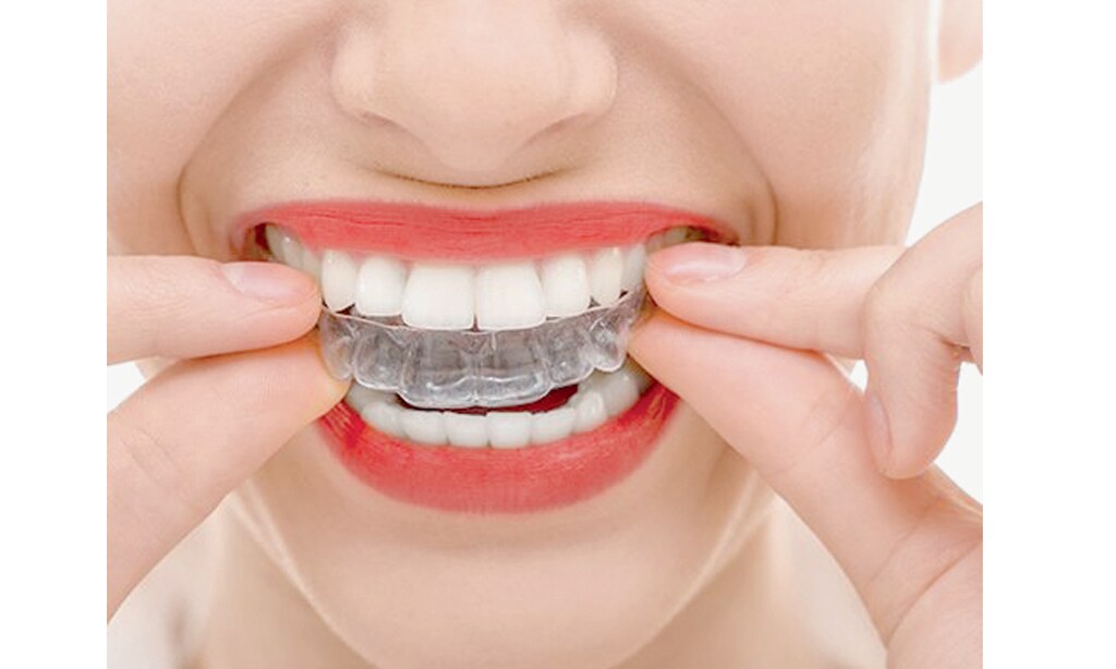 Product image for Dental Progress STARTING AT $77/mth with credit approval invisalign treatment. 