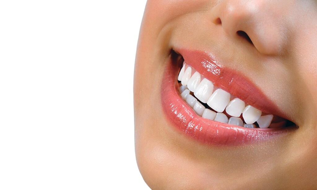 Product image for Healing Hands Dental $1000 Off Invisalign Treatment & Free Consultation
